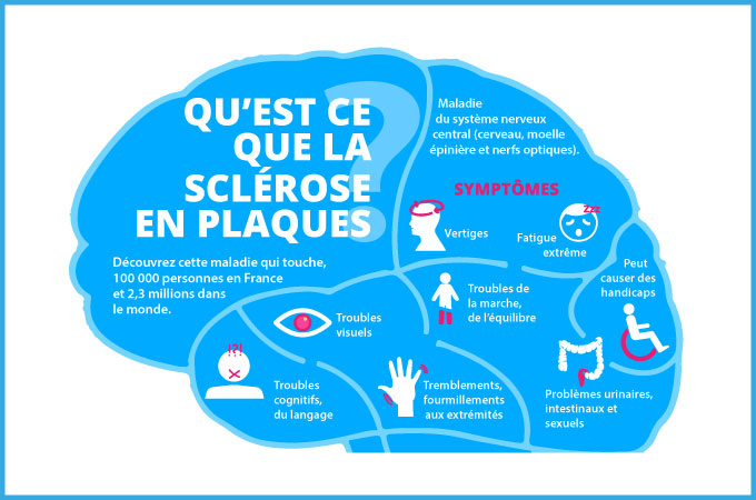 Sclérose en plaques